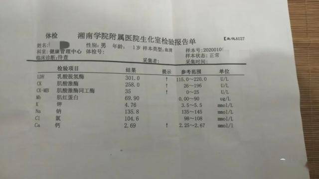 制证照片和人口照片相似度低怎么办