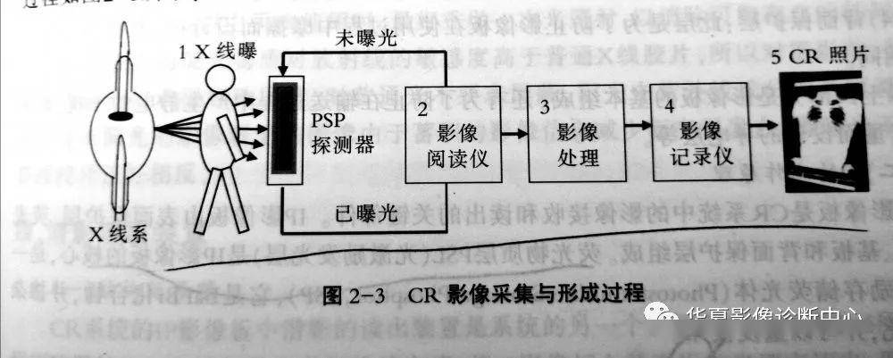 课外读物计算机x线摄影cr的那点事