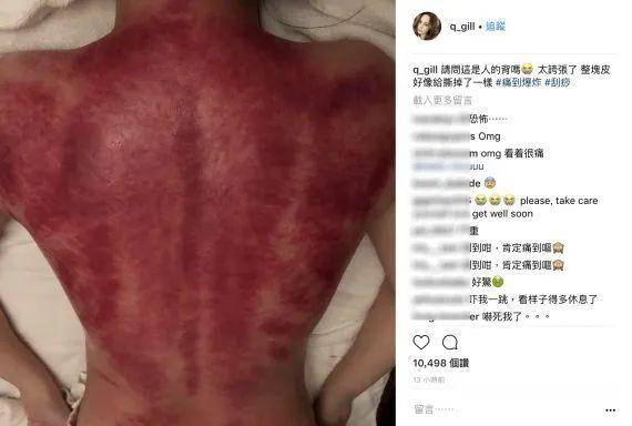 成语刮什么湔肠_成语故事简笔画