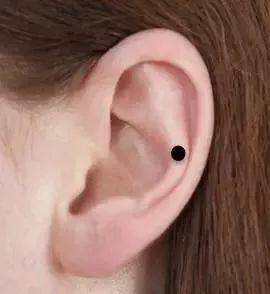 女人耳朵上的痣代表什么?