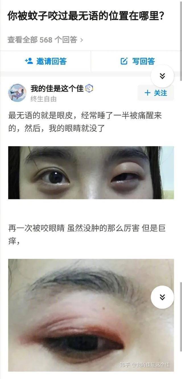 迎香穴部位照片 5c18891f81674ddeb87f59857e0ba222.jpeg