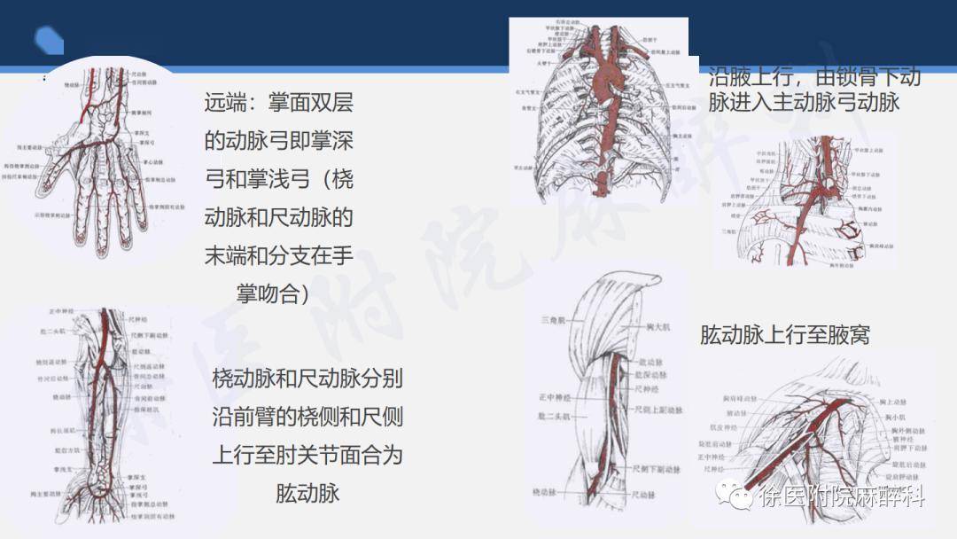 对所有艾伦试验结果患者行经桡动脉冠状动脉导管插入术和介入治疗晚课