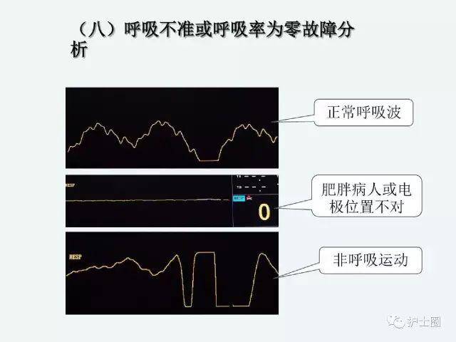 怎么看心电监护仪列表 1aac79e5c1684ad2807cb395012bbda0.jpeg
