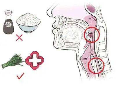 差点成舌癌!汕尾一阿姨舌头肿痛,原来这东西在里面卡了半年.