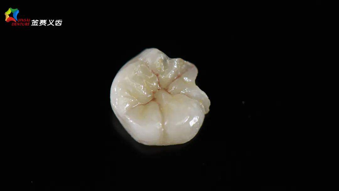 瓷嵌体牙体如何预备?