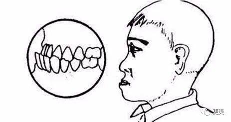 凸嘴怎么画 90732f53b3164cd79162afd97602a109.jpeg