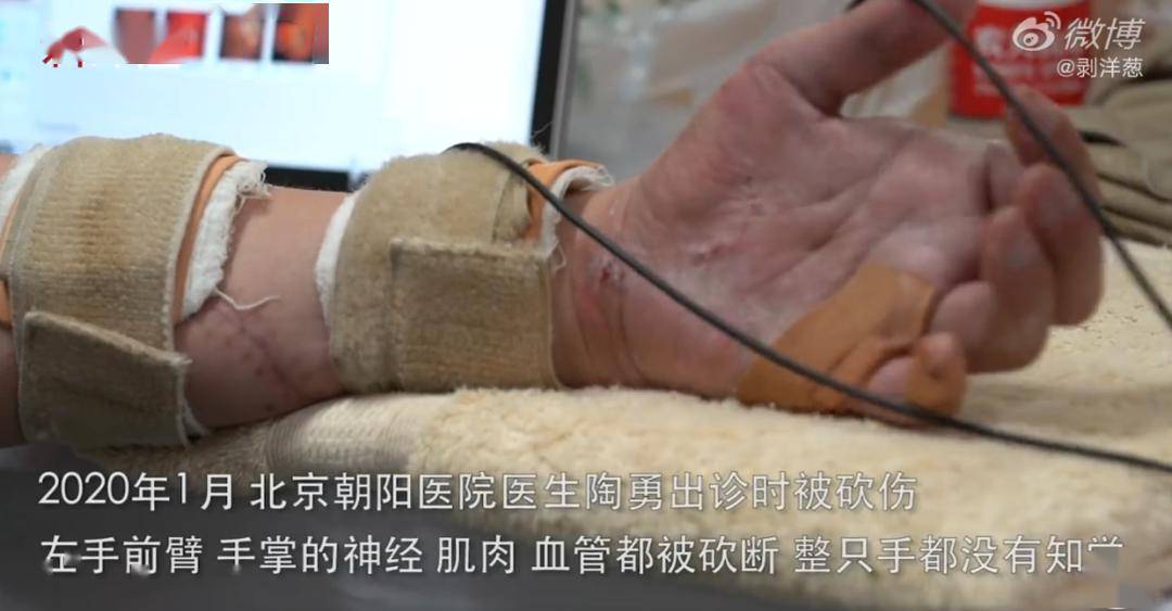 看哭.被病人狂砍的眼科医生陶勇复工就诊:手太疼,太难受了
