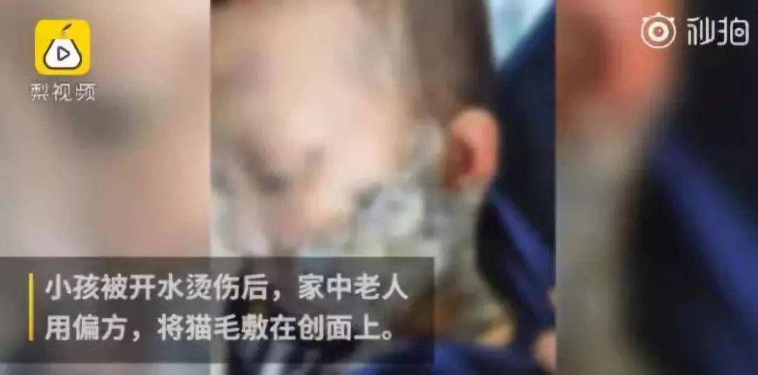 孩子|不及格的父母对孩子的伤害太大了这2个育儿误区害了无数宝宝