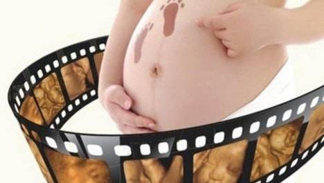 怀孕几周去做四维彩超比较好？去做四维彩超前，孕妈应注意什么？