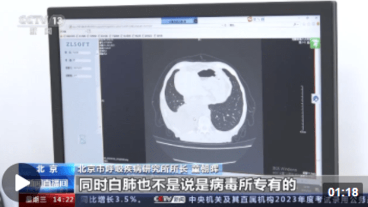感染甲流可能引起白肺吗?