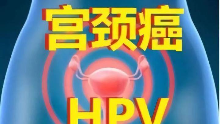 男子两任妻子都查出宫颈癌,你觉得可能和丈夫有关吗?