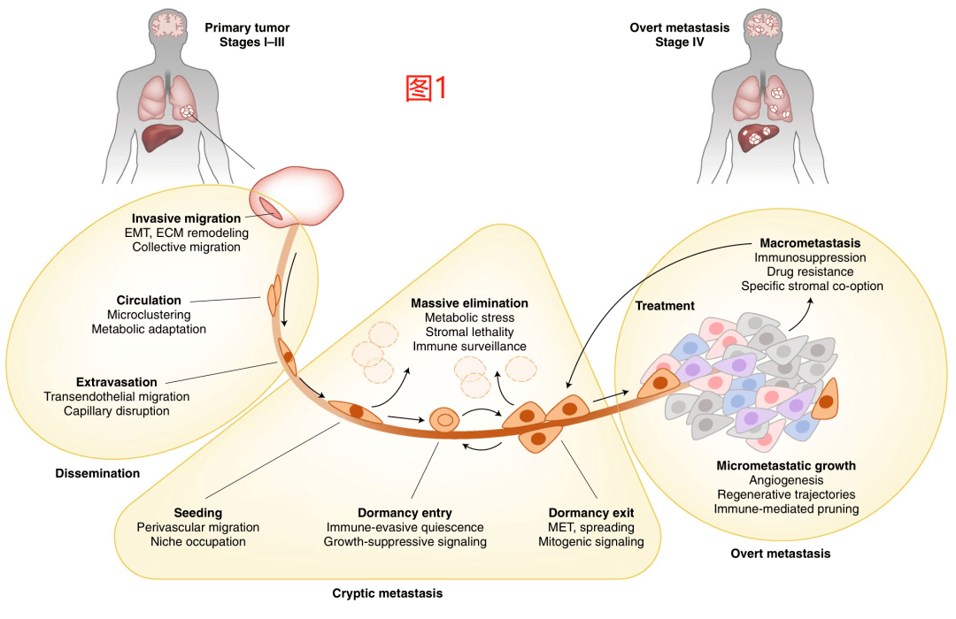nature子刊最新综述:靶向转移性癌症.刷新你对肿瘤的认识!