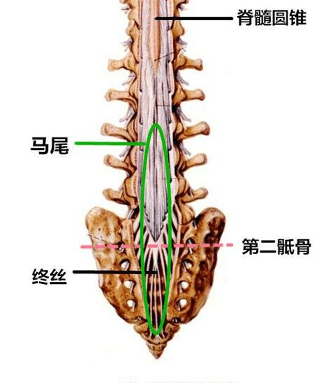 为什么终丝脂肪变性会发展成马尾神经损伤?_脊髓