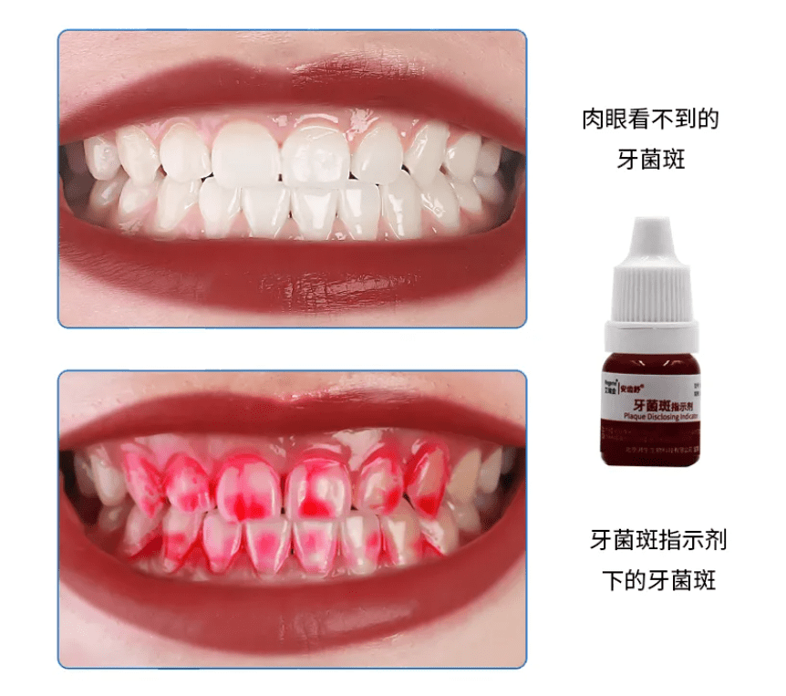 安齿舒,北京湃生生物,牙菌斑指示剂