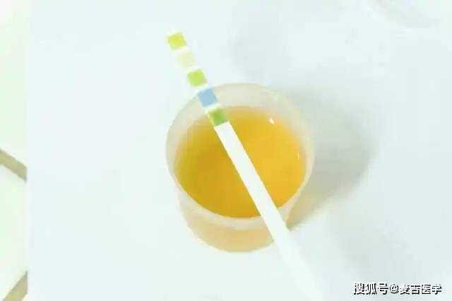 尿液是健康的晴雨表教你如何通过自己的尿液发现健康问题
