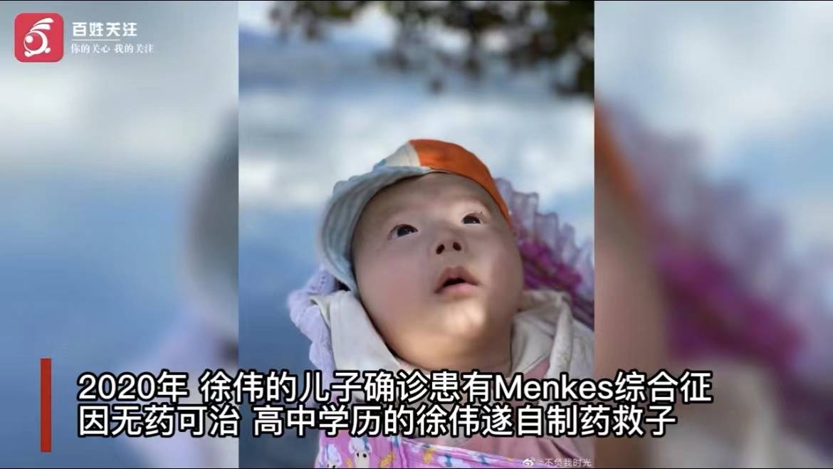 自制药救儿,儿子刚过3岁生日_徐伟_百姓_menkes