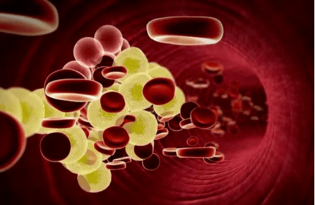 什么是高密度脂蛋白有什么作用 517078979a114a0f9cdebef0116b8dd5.png