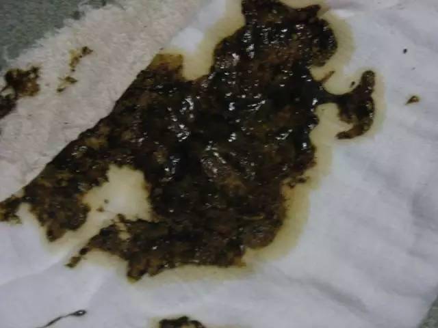 奶瓣绿便腹泻便秘宝宝的各种便便真图全解建议收藏