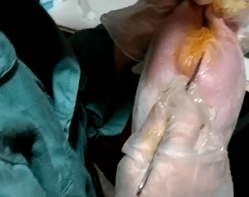 b,绑定者一手提一只后腿,腹部面向手术者,保持前肢悬空远离地面,坐下