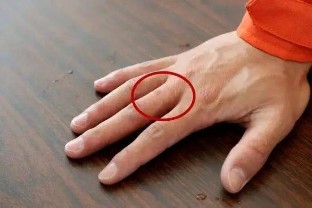 几个月会吃手指头 ea30a966fa424cdcad7681e37f8a19a9.jpeg