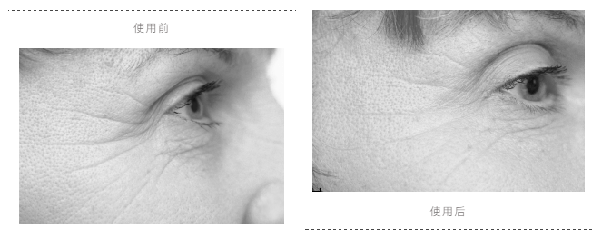 瑞典33位女性经3个月实测：变态眼霜把70岁奶奶的眼纹淡化了，还消水肿