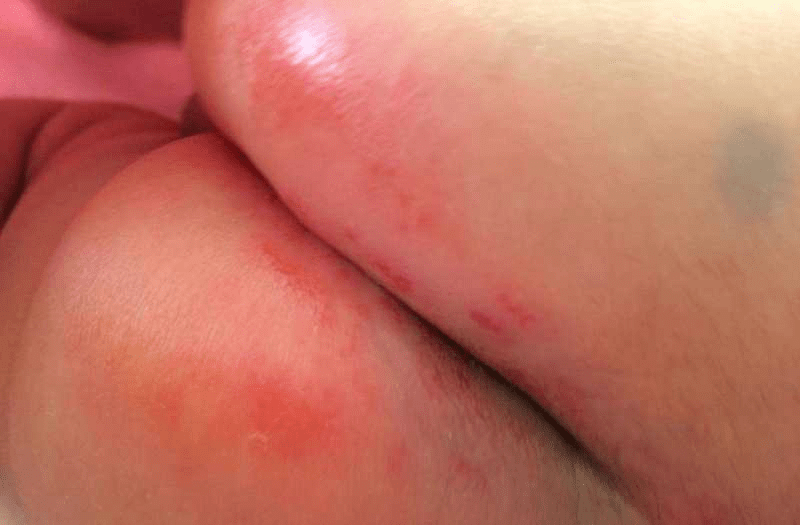 屁屁乐可以用吗 11f61aa327574ed1a4048acd7fa5aadd.png
