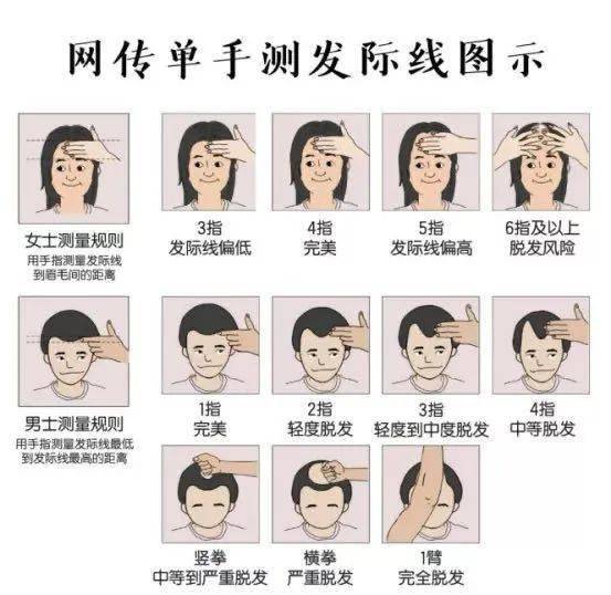 脱发严重是什么原因 怎么办 331dad1eca1148b18d3d388ceabb297c.jpeg