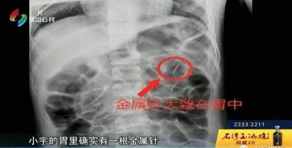 梦境的隐喻，解析连续梦见左上大牙掉落腐臭食物残渣的深层含义