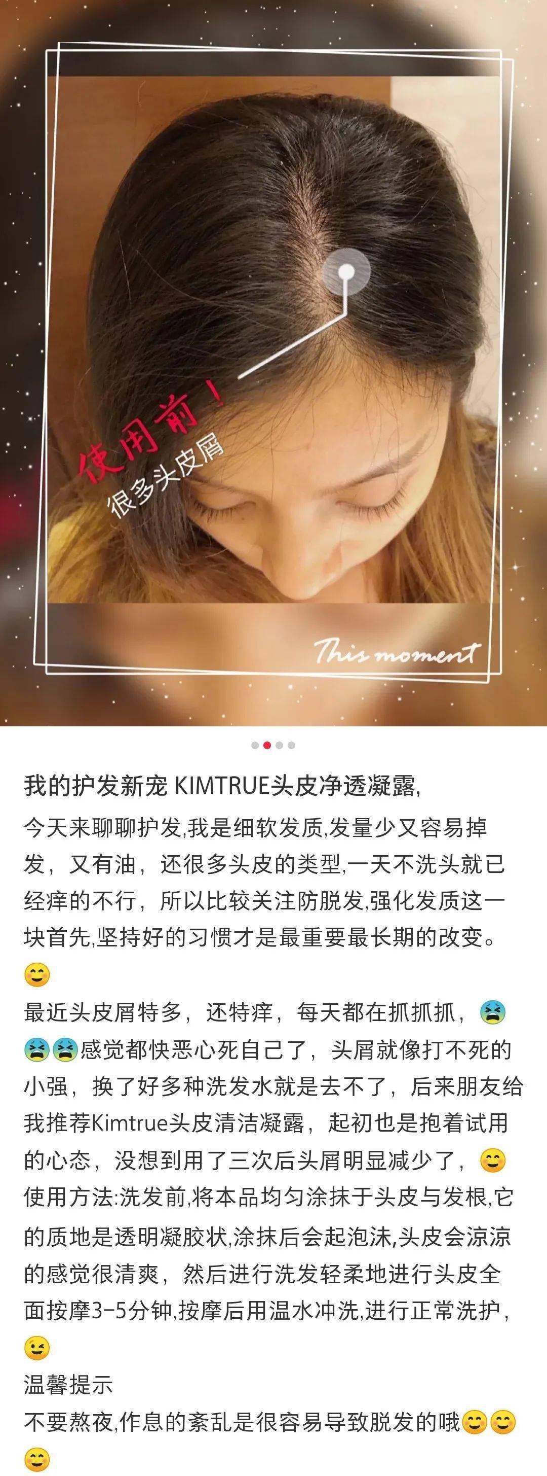 李佳琦推荐的脱发克星!一次就能拯救头屑头痒头油,用了它头发都会跳舞!