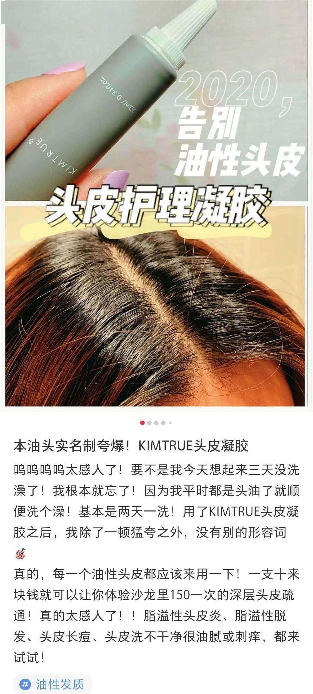 李佳琦推荐的脱发克星!一次就能拯救头屑头痒头油,用了它头发都会跳舞!