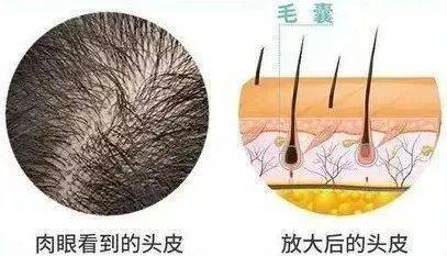 李佳琦推荐的脱发克星!一次就能拯救头屑头痒头油,用了它头发都会跳舞!