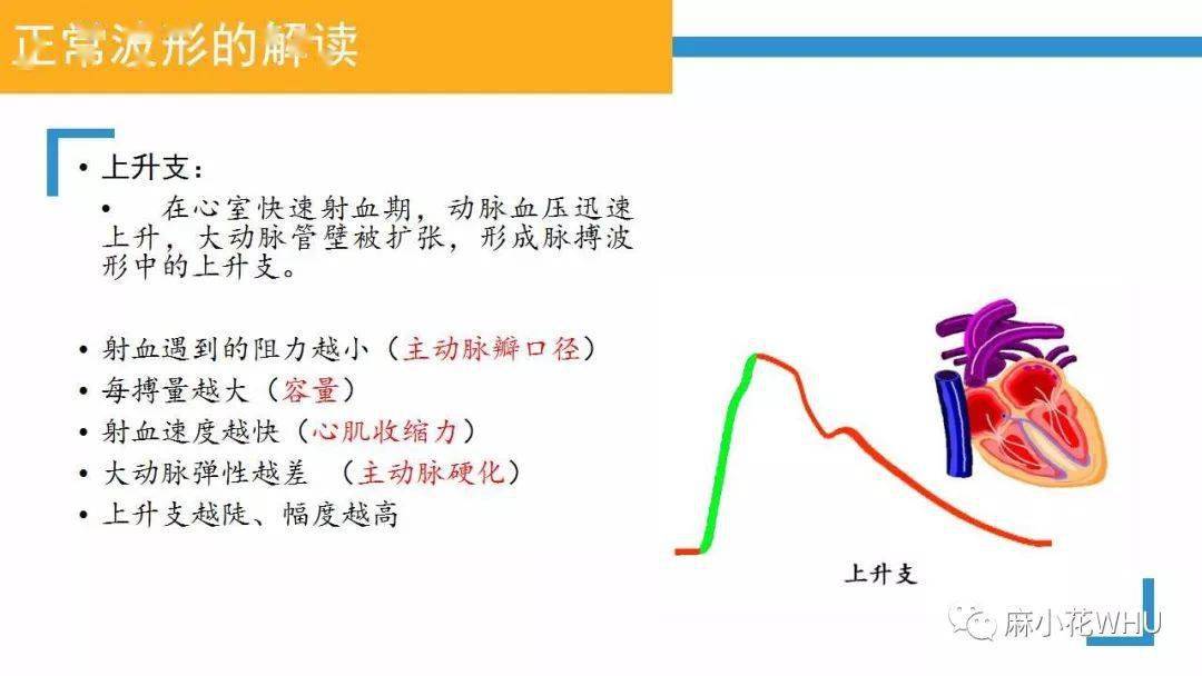 如何做好有创动脉血压监测及其波形分析?史上最详细的解读来了!