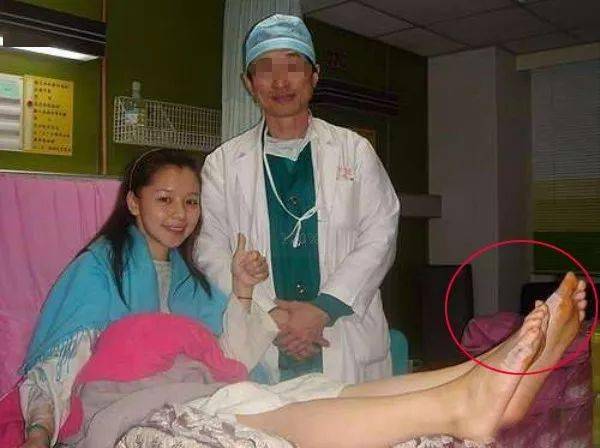 大脚趾外翻疼痛缓解 51b44399238146fda96614b32f4f7f3f.jpeg