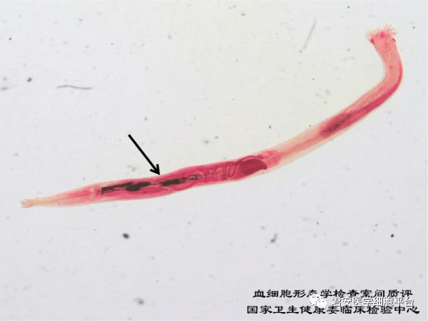 点击空白处查看答案钩虫成虫请报告图中箭头所指对象的名称(大小约为