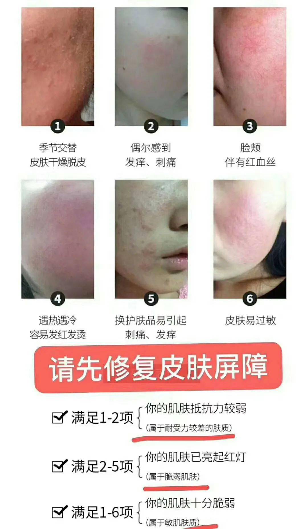 疱疹怎么样才能快速好 4245f3650a764c0fbac3faa183731f10.jpeg