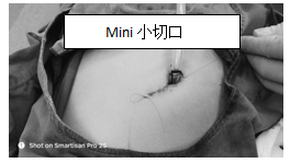 f7881b6eac7d4c5da95cdac2dc0df0e6.png