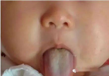 爱乐|【石外·爱乐国际早教】——宝宝积食怎么办！