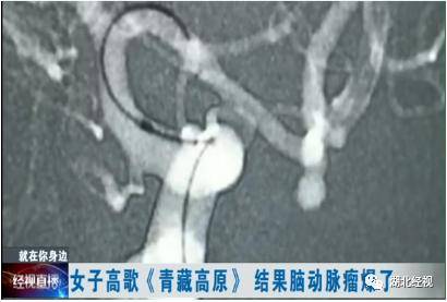 大妈|大妈聚会飙了这首歌，险些丢命……