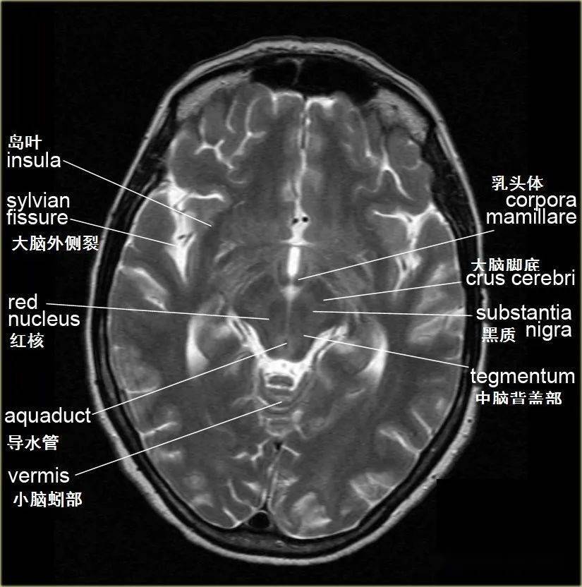 学习借鉴脑的断面解剖