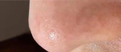 毛孔|原来想要拥有干净、清透的“初恋素颜脸”，只需要做好这一步！