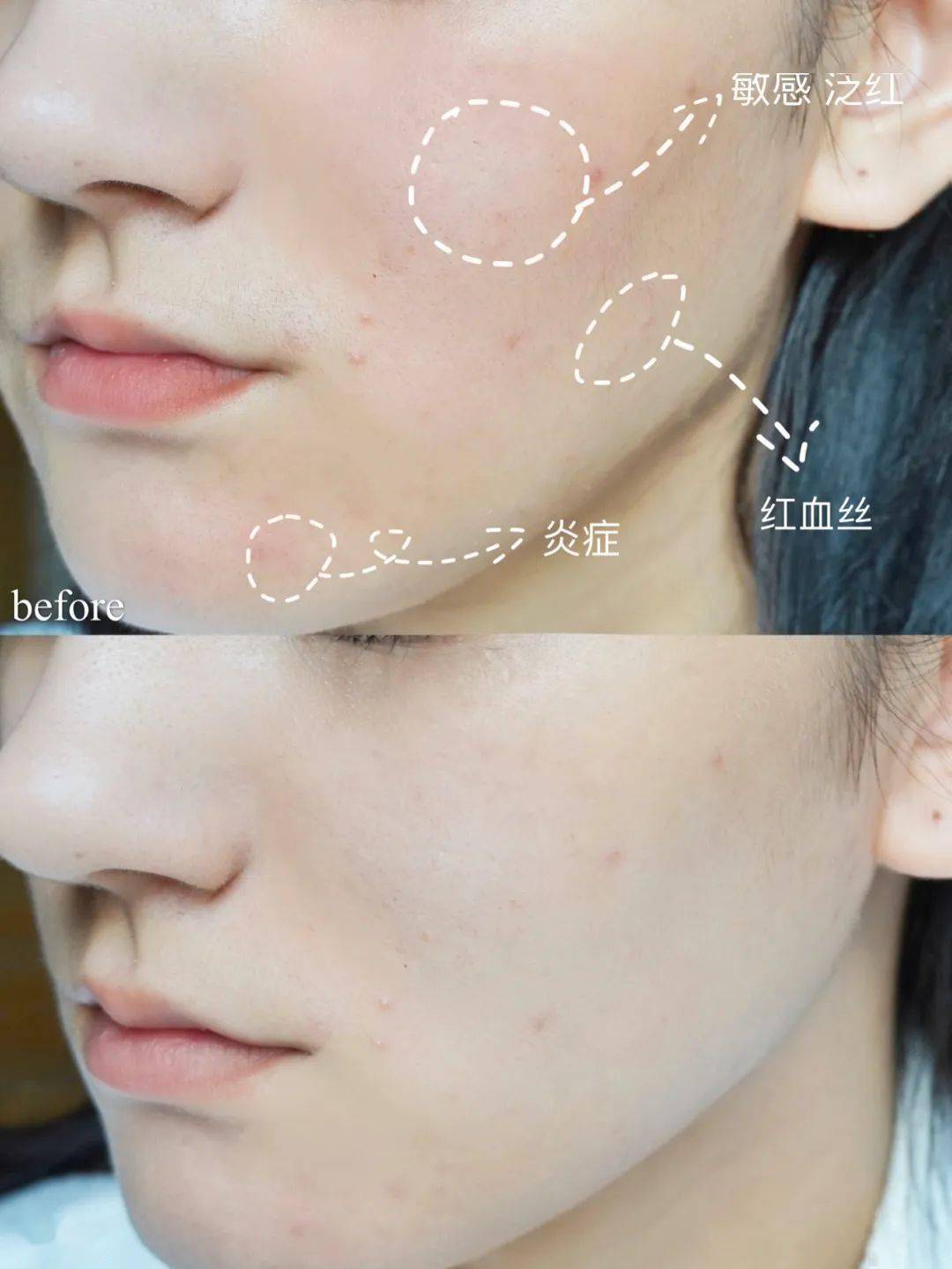 毛孔|原来想要拥有干净、清透的“初恋素颜脸”，只需要做好这一步！