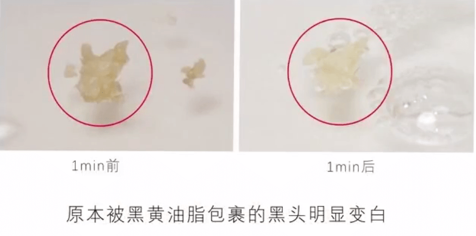 毛孔|原来想要拥有干净、清透的“初恋素颜脸”，只需要做好这一步！