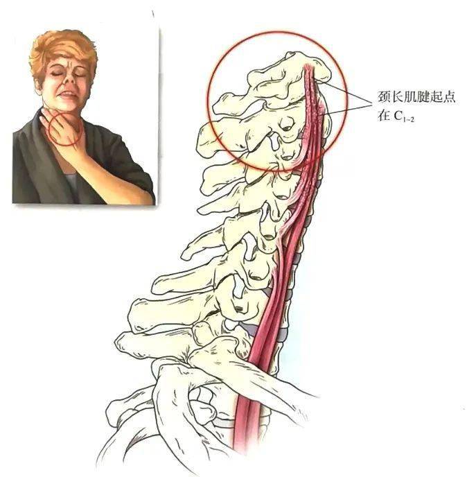 06 颈胸椎棘突间滑囊炎 临床综合征 颈椎下部和胸椎上部的棘突间韧带