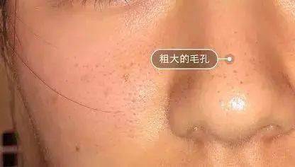 毛孔|原来想要拥有干净、清透的“初恋素颜脸”，只需要做好这一步！