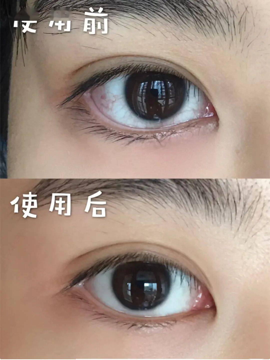 眼罩|明亮双眸!新一代冰感眼罩,冰热双温SPA,赶走黑眼圈、红血丝!