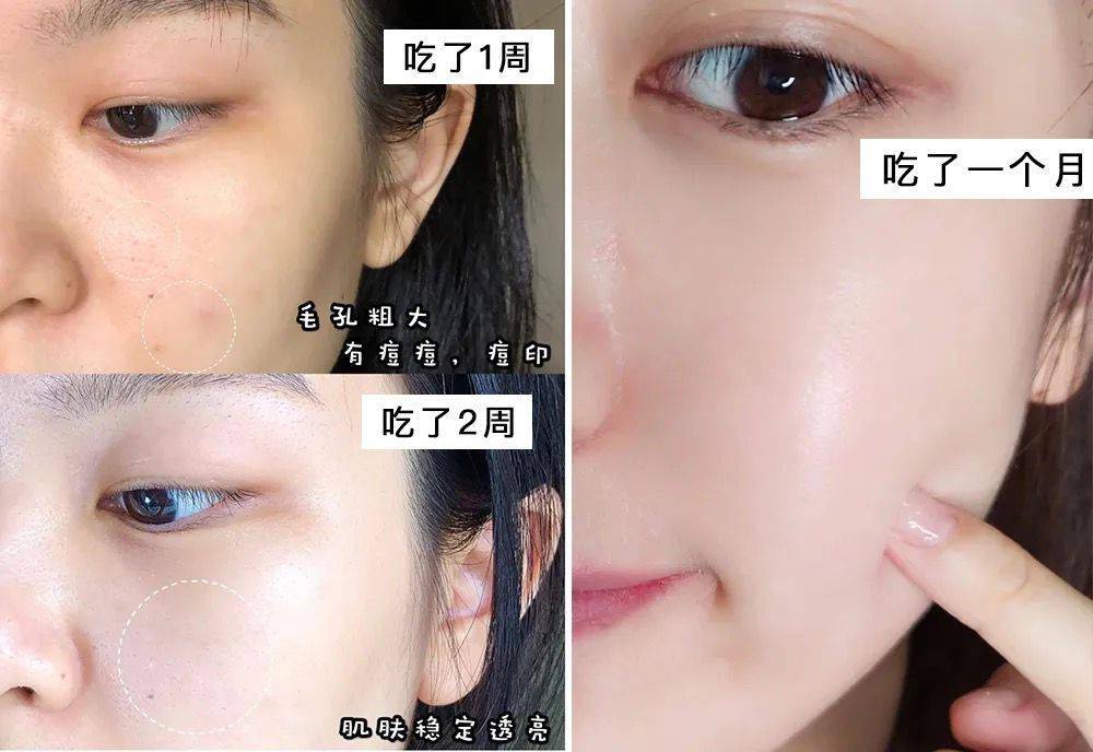 大妈|2个月狂甩56斤！160斤韩国大妈变全民女神！秘诀竟然是吃它？