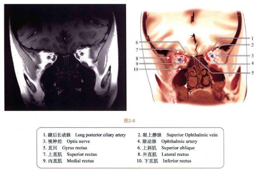 速查图谱眼眶mri断层解剖