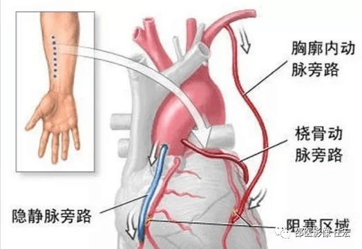d3f514c080d9404caa2e19c6317d80d0.png