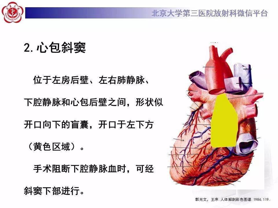 影像精美解剖丨心包窦及心包隐窝解剖,建议收藏!