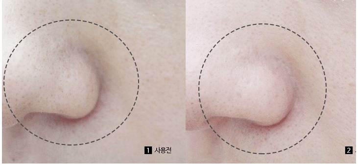 角质|能搓出“脏东西”的它3秒卖出一瓶！去角质、黑头、收毛孔，给你肌肤来次“大扫除”!